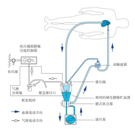 体外循环机